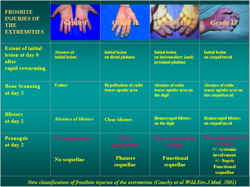 Les dorsalgies du médicament les gels