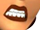 dents