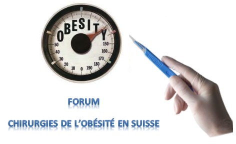 Chirurgie de l'obésité en Suisse Index du Forum